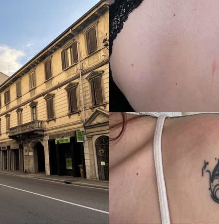 In alto a destra i graffi ieri sera sulla schiena dell'amica, sotto i lividi che Chiara questa mattina ha trovato sulla sua spalla In alto a destra i graffi ieri sera sulla schiena dell'amica, sotto i lividi che Chiara questa mattina ha trovato sulla sua spalla