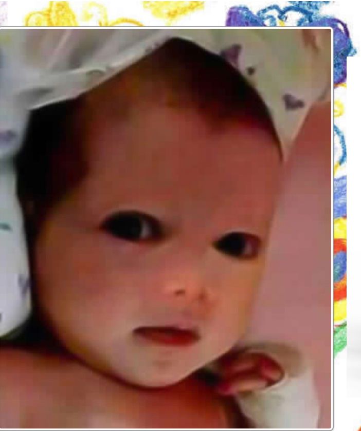 La piccola Chiara, una terapia neonatale donata in suo nome