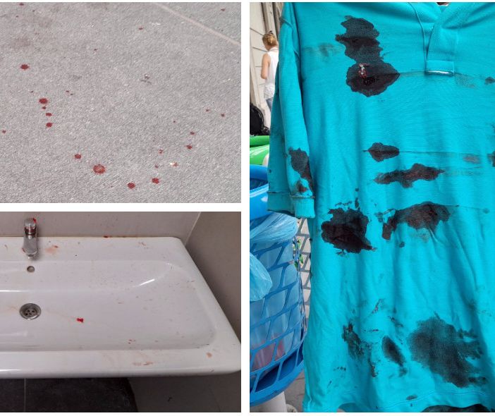 Le tracce di sangue sul pavimento e sul lavandino: la maglietta sporca di sangue con il quale è stata tamponata la ferita della vittima Le tracce di sangue sul pavimento e sul lavandino: la maglietta sporca di sangue con il quale è stata tamponata la ferita della vittima