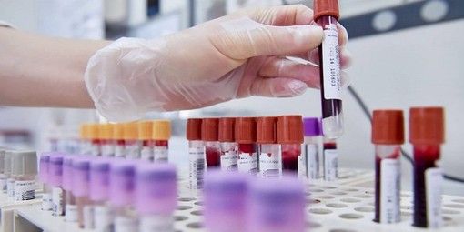 Covid, nell'ultima settimana in provincia di Varese 3.539 nuovi positivi