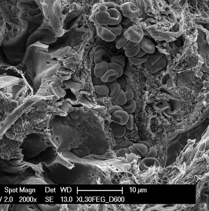 Nuove prospettive per il trattamento delle lesioni nei tessuti grazie a una ricerca Insubria