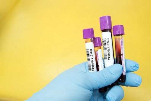 Ats Insubria, parte la nuova organizzazione dei punti tampone