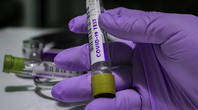 Coronavirus, i dati di domenica 3 gennaio: nel Varesotto 408 casi. Varese +25, Busto +43, Gallarate +6, Saronno +7