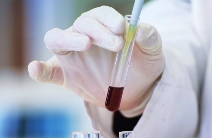 Punti prelievi, dopo Viggiù a pieno regime anche Malnate