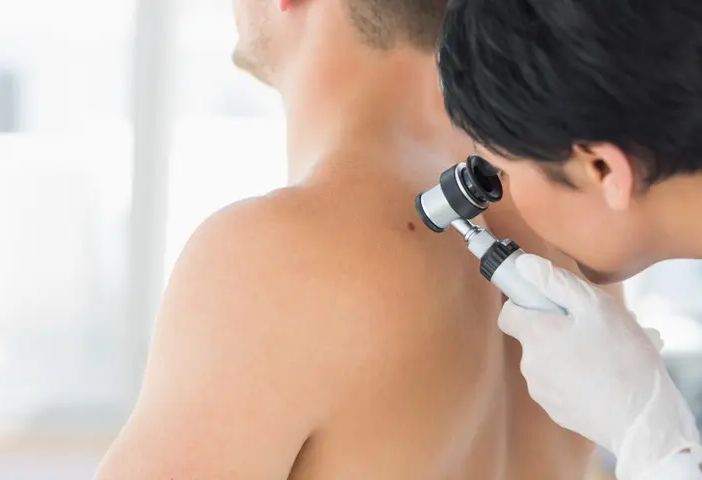 Effetti negativi del sole: invecchiamento precoce e tumori cutanei