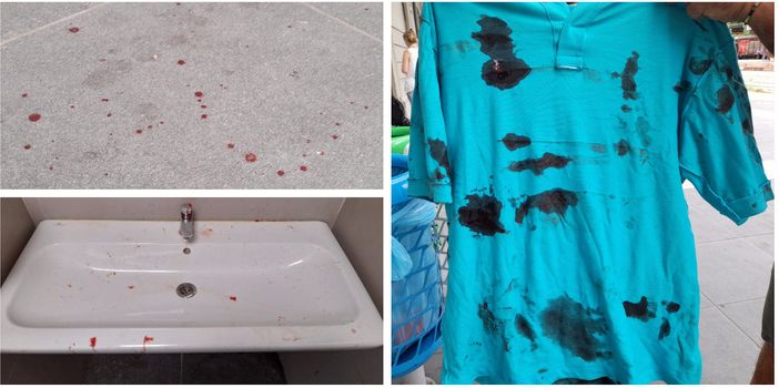 Le tracce di sangue sul pavimento e sul lavandino: la maglietta sporca di sangue con il quale è stata tamponata la ferita della vittima