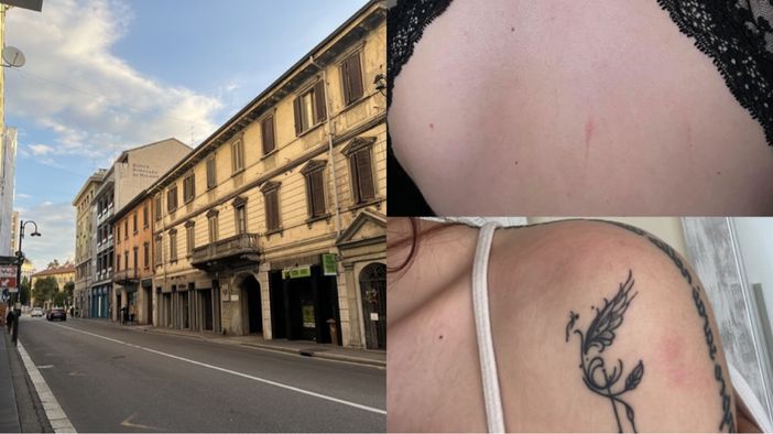 In alto a destra i graffi ieri sera sulla schiena dell'amica, sotto i lividi che Chiara questa mattina ha trovato sulla sua spalla In alto a destra i graffi ieri sera sulla schiena dell'amica, sotto i lividi che Chiara questa mattina ha trovato sulla sua spalla
