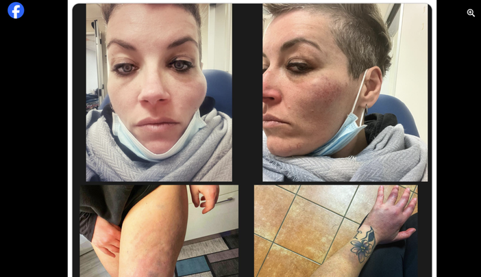 Le foto postate dalla cantante sulla sua pagina Facebook