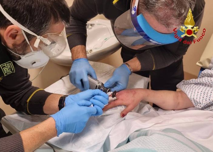 Anello incastrato al dito. Al Circolo per rimuoverlo arrivano i vigili del fuoco Anello incastrato al dito. Al Circolo per rimuoverlo arrivano i vigili del fuoco