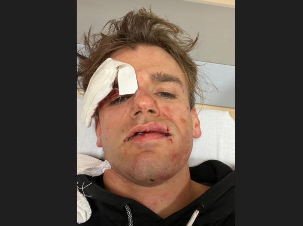 Aggredito e rapinato a Varese Jacopo Malnati de iPantellas