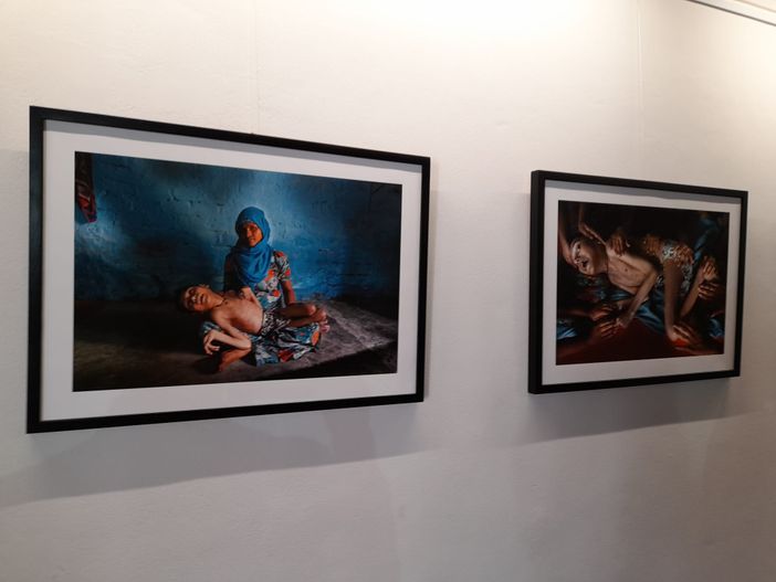 Gallarate: la pelle, la lotta e un bacio in mostra