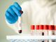 Coronavirus, il punto in provincia: Varese +37, Busto +27, Gallarate +29, Saronno +15