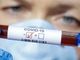 Coronavirus, i dati di venerdì 12 marzo: nel Varesotto 610 contagi. Varese +71, Busto +59, Gallarate +20, Saronno +25