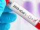 Coronavirus, i dati di lunedì 8 marzo: nel Varesotto 85 contagi. Varese +6, Busto +7, Gallarate +3, Saronno +6