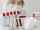 Coronavirus, i dati di lunedì 17 maggio. In provincia 186 casi: Varese +17, Busto +15, Gallarate +4, Saronno +7, Luino +3