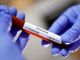 Coronavirus, il punto in provincia: Varese +14, Busto +8, Gallarate +31, Saronno +3