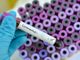 Coronavirus, oggi 89 contagi in provincia di Varese. In Lombardia 574 casi e nessuna vittima