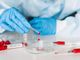 Coronavirus, i dati di giovedì 21 gennaio: nel Varesotto 223 contagi. Varese +26, Busto +25, Gallarate +7, Saronno +17