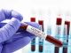 Coronavirus, i dati di venerdì 22 gennaio: nel Varesotto 213 contagi. Varese +17, Busto +19, Gallarate +12, Saronno +9