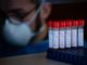 Coronavirus, i dati di giovedì 7 gennaio: nel Varesotto 566 contagi. Varese +50, Busto+52, Gallarate +30, Saronno +7