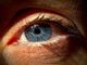 Diabete, visite oculistiche gratuite a Varese: «In Lombardia vista a rischio per migliaia di pazienti»