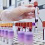 Alert su difterite in Ue, l'infezione continua a colpire in Europa