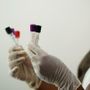 Hantavirus, turista inglese "contatto di caso" in quarantena all’ospedale Sacco