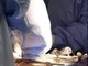Bimba piuma operata al cuore a Milano, salvata da San Raffaele-San Donato