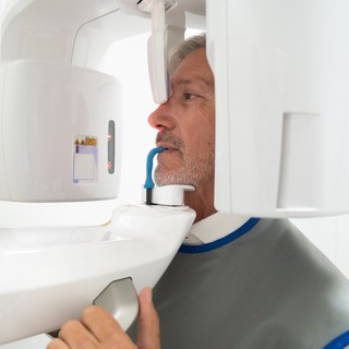 Le nuove tecniche di implantologia dentale