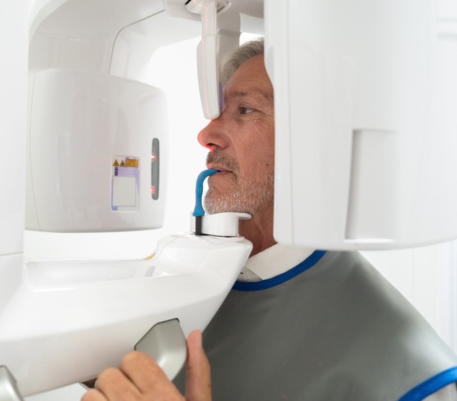Le nuove tecniche di implantologia dentale