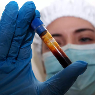 Hantavirus, un’ulteriore turista inglese, contatto di caso, in quarantena al  Sacco di Milano. Bertolaso: «Negativi gli accertamenti virologici previsti»