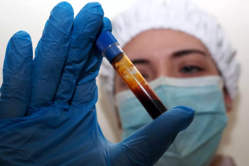 Hantavirus, un’ulteriore turista inglese, contatto di caso, in quarantena al  Sacco di Milano. Bertolaso: «Negativi gli accertamenti virologici previsti»