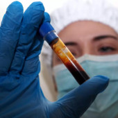 Hantavirus, un’ulteriore turista inglese, contatto di caso, in quarantena al  Sacco di Milano. Bertolaso: «Negativi gli accertamenti virologici previsti»