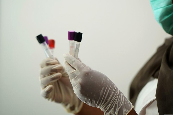 Hantavirus, turista inglese "contatto di caso" in quarantena all’ospedale Sacco Hantavirus, turista inglese "contatto di caso" in quarantena all’ospedale Sacco