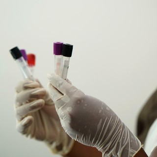 Hantavirus, turista inglese "contatto di caso" in quarantena all’ospedale Sacco