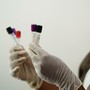 Hantavirus, turista inglese "contatto di caso" in quarantena all’ospedale Sacco