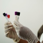 Hantavirus, turista inglese "contatto di caso" in quarantena all’ospedale Sacco Hantavirus, turista inglese "contatto di caso" in quarantena all’ospedale Sacco