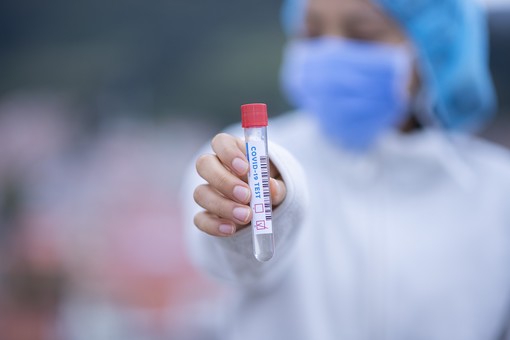 Coronavirus, in provincia di Varese 148 nuovi contagi. In Lombardia 1.431 casi e 2 vittime