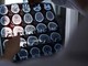 Nuove molecole e bersagli, così si evolve la terapia contro l'Alzheimer: il punto