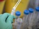 Legionella in case popolari a Milano, un morto e diversi ricoverati