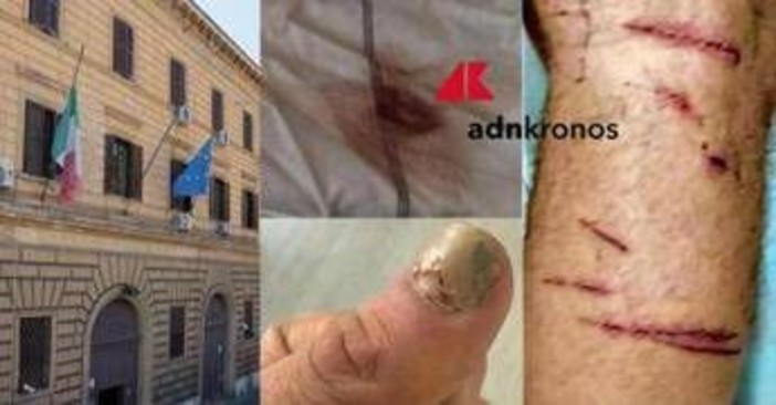 Denunciò botte e sequestro in cella: "Ora vivo nella paura, colpisce il silenzio delle istituzioni"