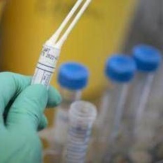 Legionella in case popolari a Milano, un morto e diversi ricoverati