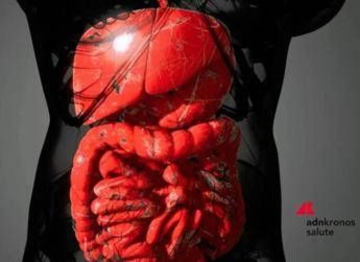 Malattie infiammatorie intestinali, rimborsabile guselkumab per colite ulcerosa e Crohn