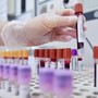 Hiv, dalla Sicilia il modello per estendere terapie long acting Hiv, dalla Sicilia il modello per estendere terapie long acting