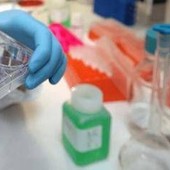 Cancro alla vescica, Berardi (Aiom): "Sangue nelle urine segnale da non sottovalutare"