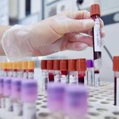 Dal microbiota una speranza contro l'epilessia resistente, lo studio italiano Dal microbiota una speranza contro l'epilessia resistente, lo studio italiano