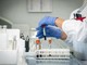 Alzheimer, nuovo test del sangue potrebbe prevedere sintomi imminenti