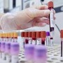 Allarme oncologi: "- 50% trial in Europa in 10 anni mentre Cina accelera"