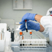 Alzheimer, test del sangue possono prevedere l'inizio dei sintomi Alzheimer, test del sangue possono prevedere l'inizio dei sintomi