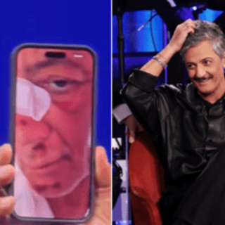 Fiorello, l'incidente in bicicletta: "Volevo fare il figo... sono caduto di faccia" Fiorello, l'incidente in bicicletta: "Volevo fare il figo... sono caduto di faccia"